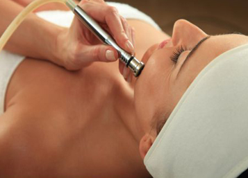 Mikrodermabrazja diamentowa